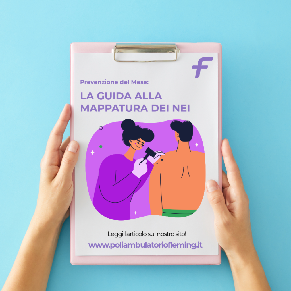 mappatura nei